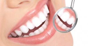 blanqueamiento dental oviedo