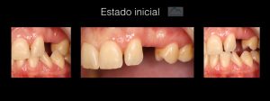 maryland inicial.001